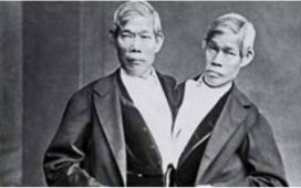 Chang și Eng, adevărații gemeni siamezi, au fost mult mai mult decât un spectacol ciudat